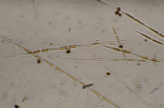 Pseudo-nitzschia <br>