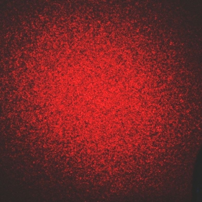 Speckle punane valgus<br>