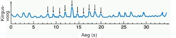 Pulsari signaal raadiosagedustel